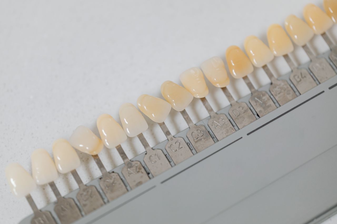 Sbiancamento denti a Siena